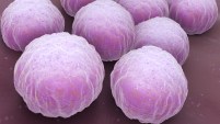 Se trata de una de las enfermedades de transmisión sexual más comunes en Estados Unidos.