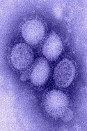 Influenza. Es uno de los más mortales y ataca las vías respiratorias. Al menos 500,000 personas mueren al año por este virus.