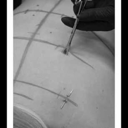 Debido a que la curación de múltiples piercings a la vez es bastante estresante para el cuerpo, la mayoría de las personas optan por llevar piercings corsé temporales.