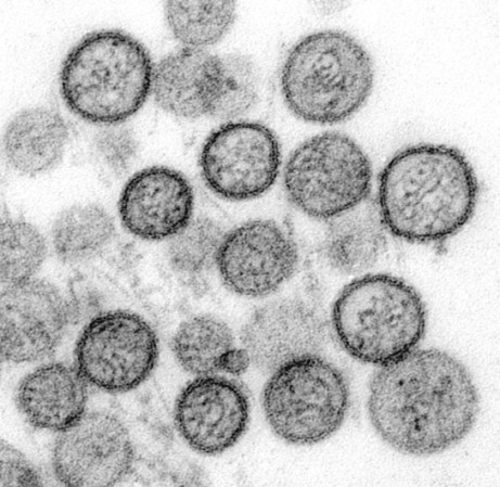El número de víctimas anuales por causa de hantavirus es de 70,000