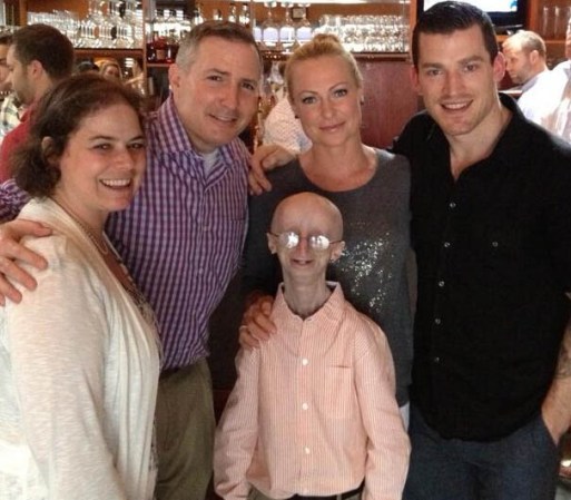 Esto es porque el síndrome genético conocido como Progeria, hace que el cuerpo humano envejezca siete veces más rápido de lo normal.