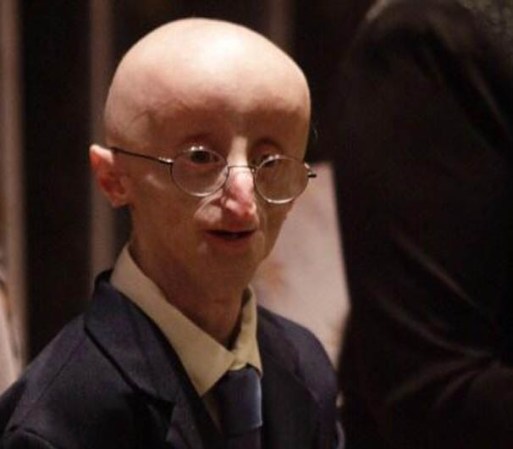A continuación más fotos de Sam Berns.