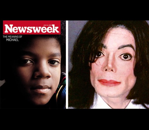El caso de Michael Jackson, sin duda se recordará como una de las más lamentables transformaciones de rostros, en la historia del entretenimiento.
