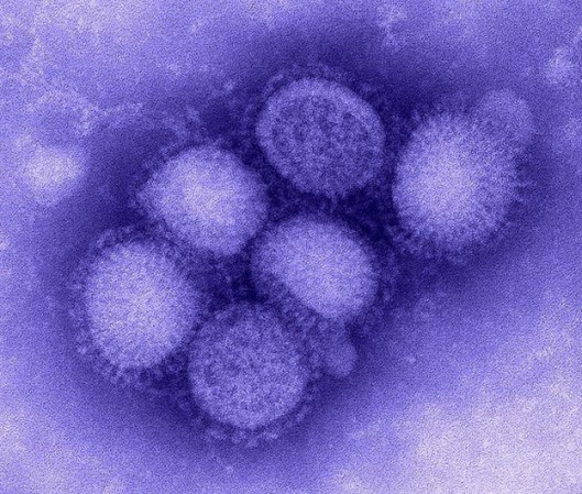 Influenza, se transmite de persona a persona a través de las gotitas de saliva de un infectado que se expulsan al hablar, toser o estornudar hasta un metro de distancia.