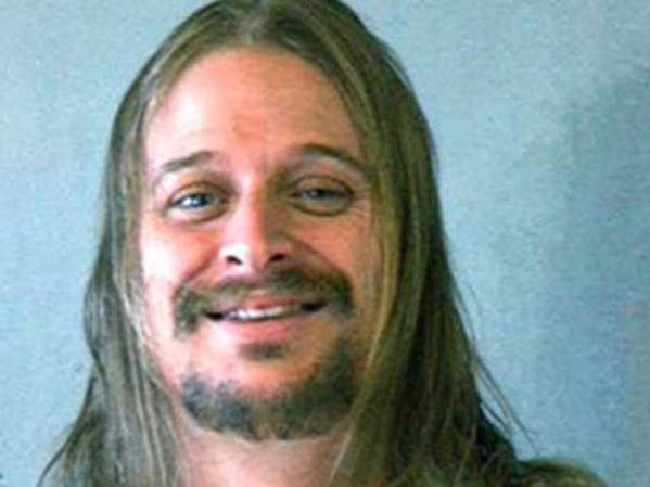 El músico Kid Rock, al ser acusado de agresión en febrero del 2005.