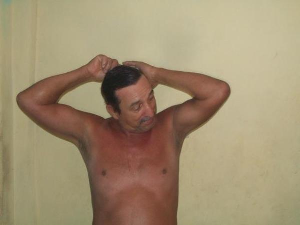 chicho el marido de mi prima odalis