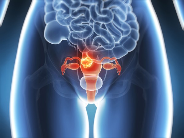 Así mismo las mujeres hispanas son 2 veces más propensas a padecer cáncer de cuello uterino que las mujeres blancas no hispanas.
