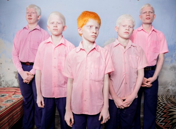 25 de septiembre 2013. Un grupo de niños albinos y ciegos fotografiados en el colegio misionero Vivekananda para ciegos en Bengala Occidental, India. Esta es una de las pocas escuelas para ciegos en India. Foto BRENT STIRTON
