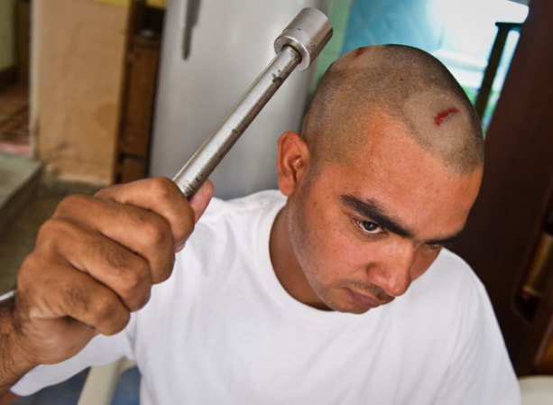 19 DE DICIEMBRE, 2011: El opositor Henry Perales muestra el golpe recibido y el arma empleada por partidarios del régimen durante un ataque contra activistas de derechos humanos en Palma Soriano el 2 de diciembre.