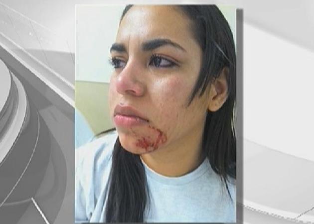 "Me empujó contra el carro y ya no pude escapar", dijo. "No podía moverme".