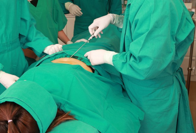 Los riegos van desde las infecciones hasta un tromboembolismo pulmonar, esto sucede cuando un glóbulo de grasa tapa los pulmones al llegar por un vaso sanguíneo.
