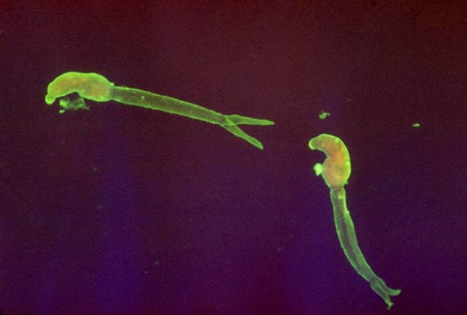 Esquistosomiasis es una infección parasitaria crónica causada por gusanos pequeños. El principal factor de riesgo para infectarse es la exposición, por actividades domésticas, laborales o recreacionales, al agua dulce contaminada con heces humanas infectadas por el parásito.