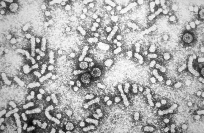 Cada año mueren 521,000 personas por Hepatitis B