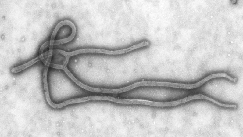 Ebola. La tasa de mortalidad de este virus es de cerca del 90%. Se transmite por intercambio de fluidos o secreciones. No existe ni vacuna ni cura. Mueren cerca de 100 personas al año.