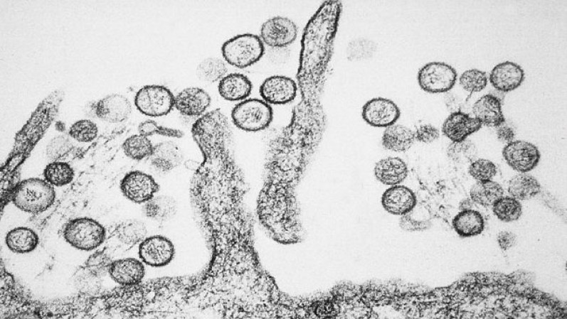 Hantavirus. Se conoce como el virus de los ratones, porque se contagia a través de las heces y la orina de estos animales. Los principales síntomas son las dificultades respiratorias que originan.