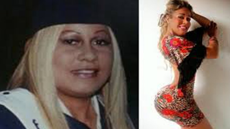 Yenis Lugo es una médica de 27 años. Desde los 19 años se ha realizado 21 cirugías plásticas en su país, Colombia. La llaman la reina de las cirugías o del bisturí.