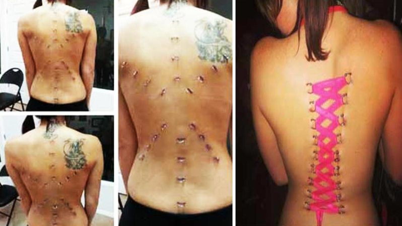 Es el último grito de la moda entre los que gustan de ponerse "aros" por todo el cuerpo, provocando polémica y discusión a su paso. Aquí las imágenes de esta práctica tan singular.
