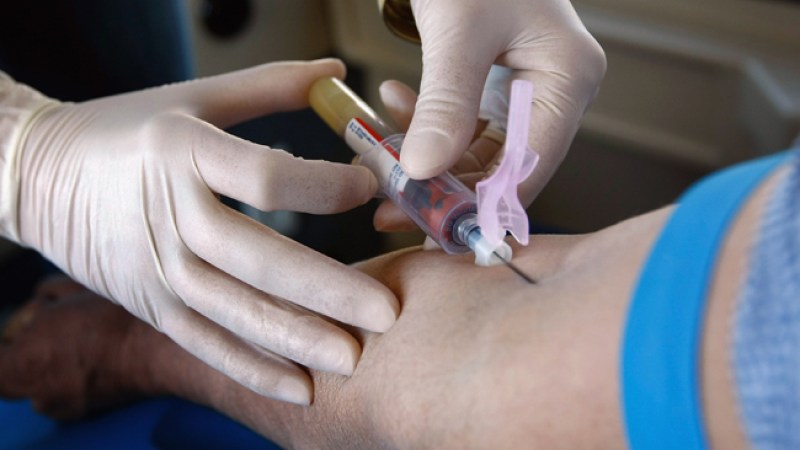 Examen de cáncer de próstata, no recomendable