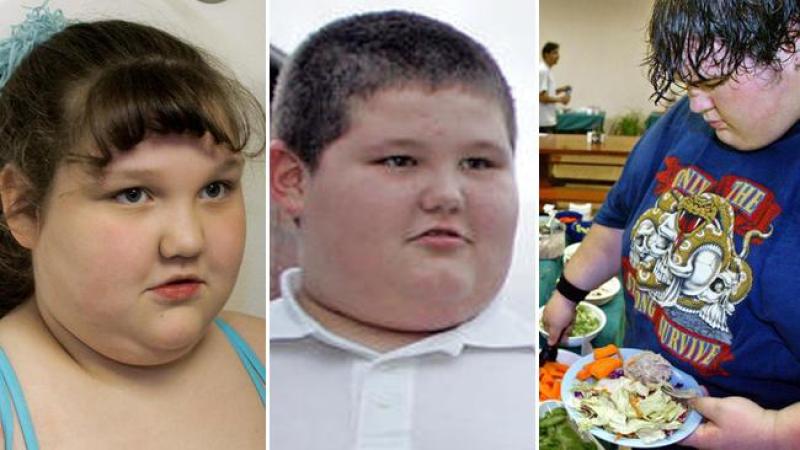 Las personas severamente obesas tienen mayor riesgo de padecer de enfermedades del corazón, derrames cerebrales, diabetes, algunos tipos de cáncer y otras condiciones relacionadas con el exceso de peso.