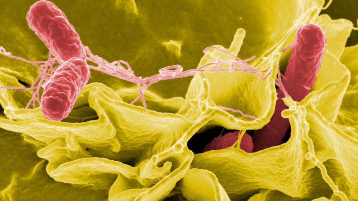 Investigan el origen de un brote de salmonela en 25 estados – Telemundo Miami (51)