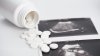 FDA aprueba venta de píldora abortiva en farmacias del país