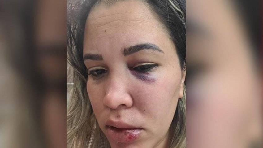 Conductora de Uber es agredida brutalmente por un pasajero en Miami –  Telemundo Miami (51)