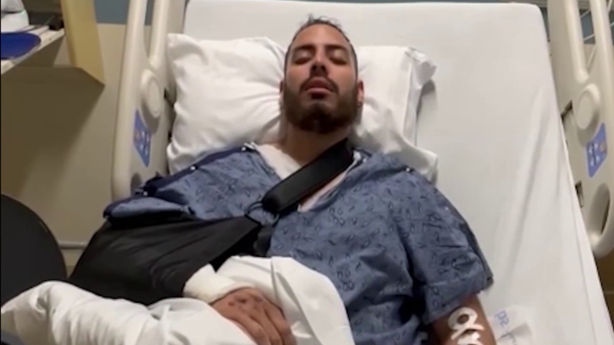 Biker hospitalized after hit-and-run speaks