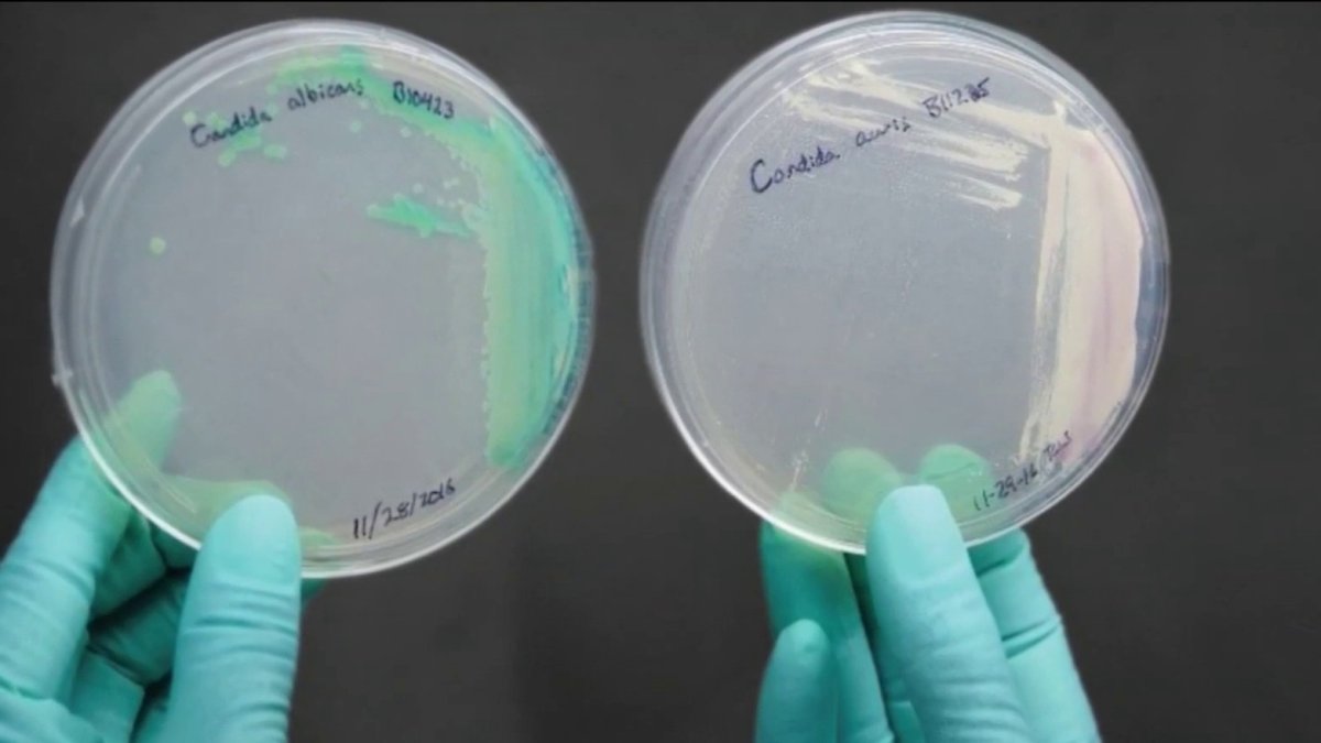 Health alert for a drug resistant fungus