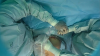 Hospital Jackson hace historia al operar a un bebé dentro del vientre de su madre