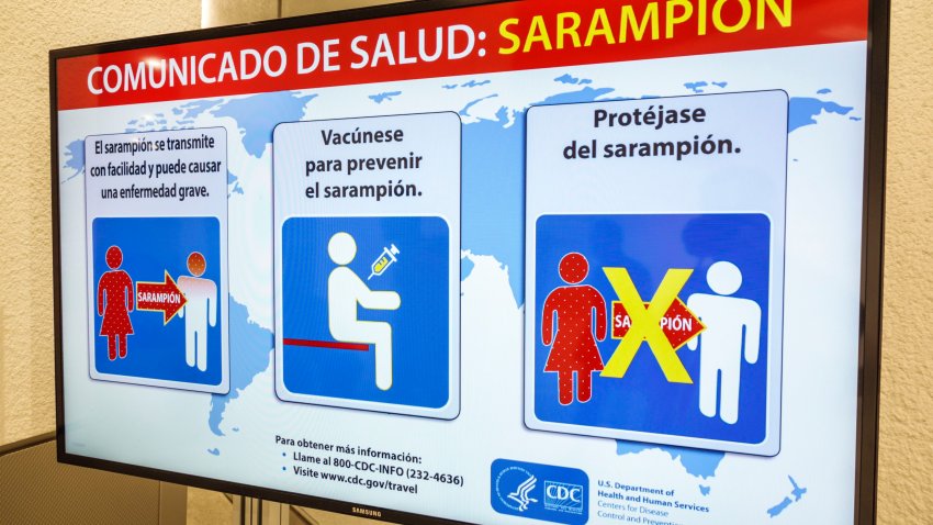 Miami International Airport, Center for Disease Control, sarampion, measles warning. (Photo by: Jeffrey Greenberg/Universal Images Group via Getty Images)