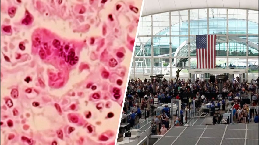 Split of measles and airport