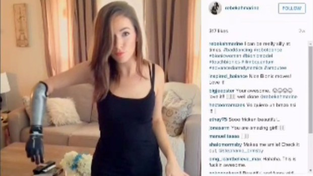 Sube a pasarela modelo con brazo biónico